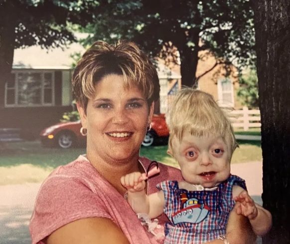 Nastolatek, któremu nie dawano więcej niż 18 miesięcy życia, ukończył liceum.