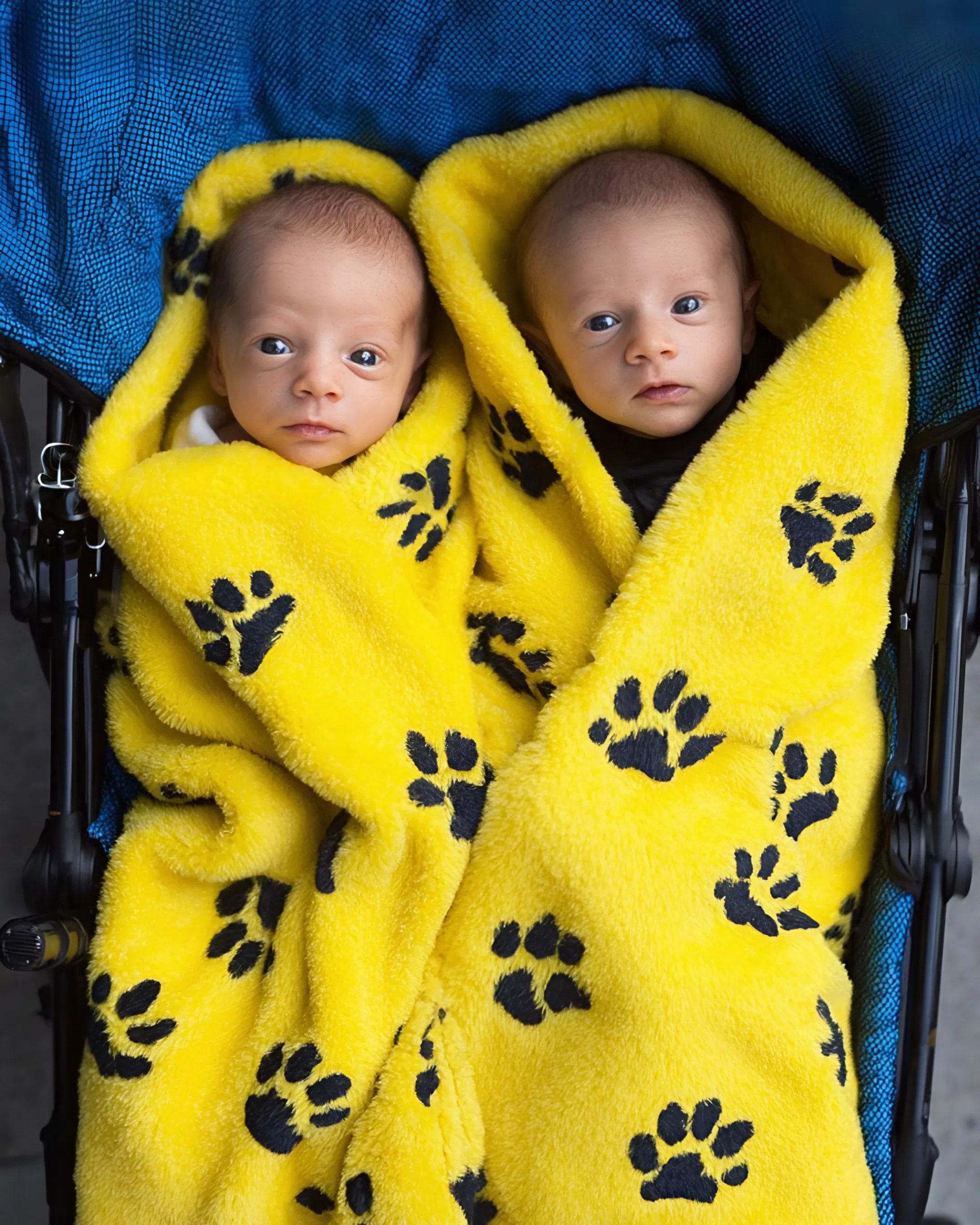 Pchała taczkę do szpitala — i niosła trzy życia na swoich bosych stopach.