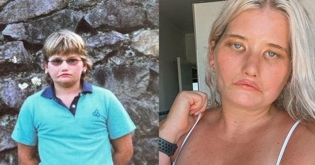 „Księżniczka bez uśmiechu”: Jak dziewczyna z tym syndromem żyje, nigdy się nie uśmiechając – Jak wygląda teraz?