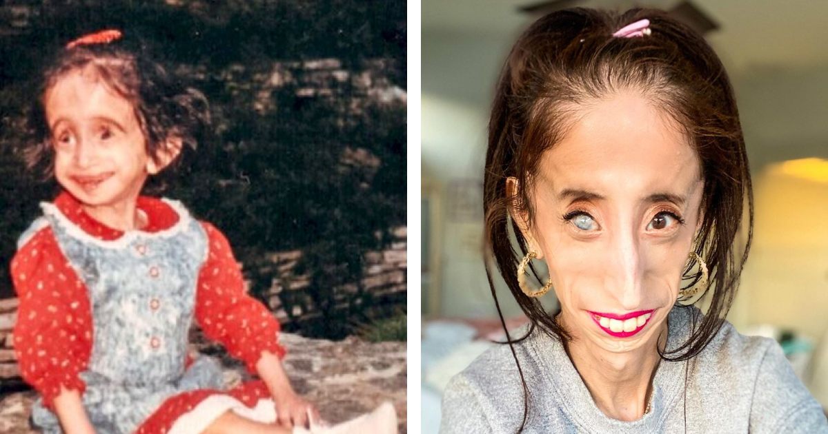 „Kobieta o okrutnym losie”: jak wygląda dziś dziewczyna, którą nazywano „najbrzydszą na świecie”?