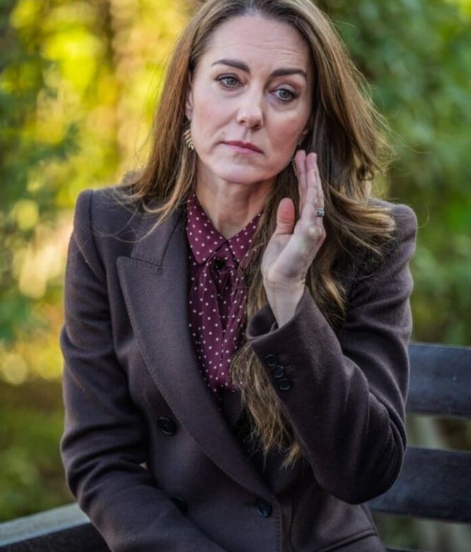 „Wyraźne worki pod oczami, zmarszczki wokół ust i zmęczone, pozbawione nadziei spojrzenie!” Tak media opisują w swoich nagłówkach wygląd Kate Middleton po chemioterapii.