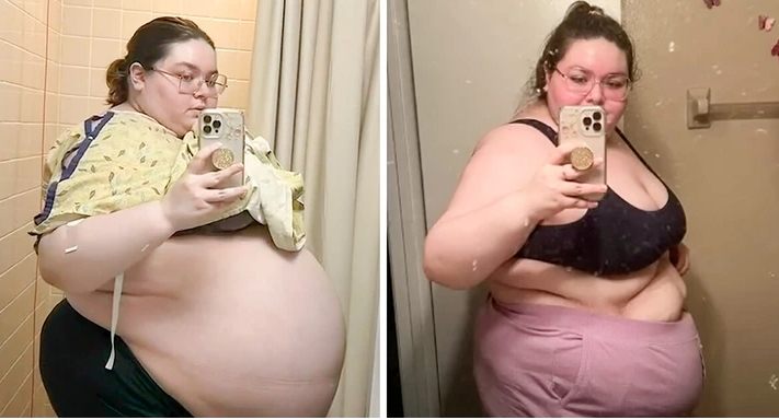 Przez lata byłam zawstydzana przez lekarzy, aż w końcu ujawniono prawdę o moim stanie!: Jak wygląda teraz?