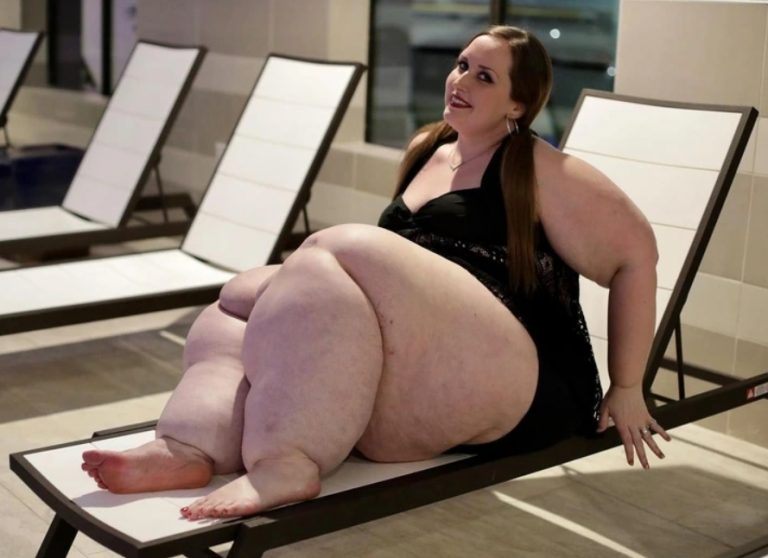 Lekarze przez lata ignorowali jej objawy, aż w końcu prawdę odkryła zupełnie obca osoba! Jak ona teraz wygląda?