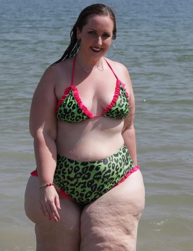 Lekarze przez lata ignorowali jej objawy, aż w końcu prawdę odkryła zupełnie obca osoba! Jak ona teraz wygląda?