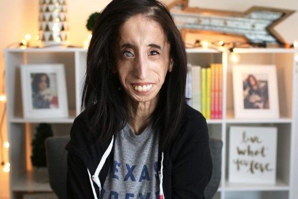 „Kobieta o okrutnym losie”: jak wygląda dziś dziewczyna, którą nazywano „najbrzydszą na świecie”?