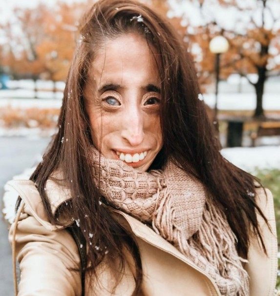 „Kobieta o okrutnym losie”: jak wygląda dziś dziewczyna, którą nazywano „najbrzydszą na świecie”?