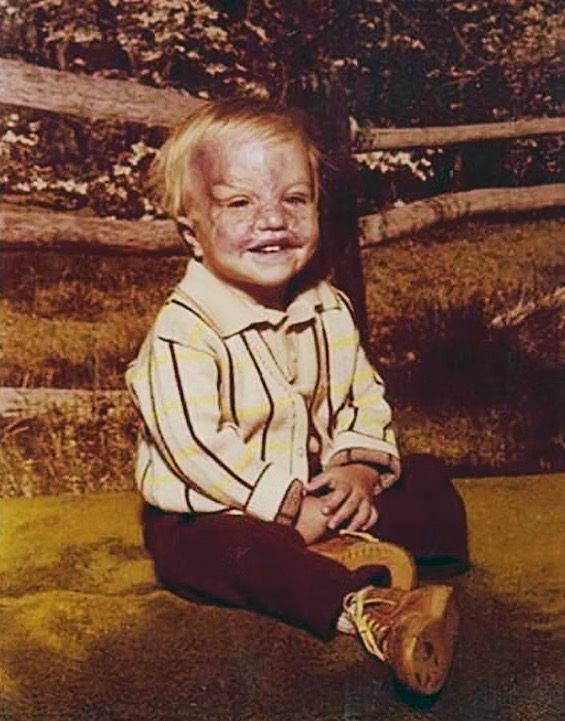 Przetrwać to, co niewyobrażalne: walka Keitha Edmondsa o życie