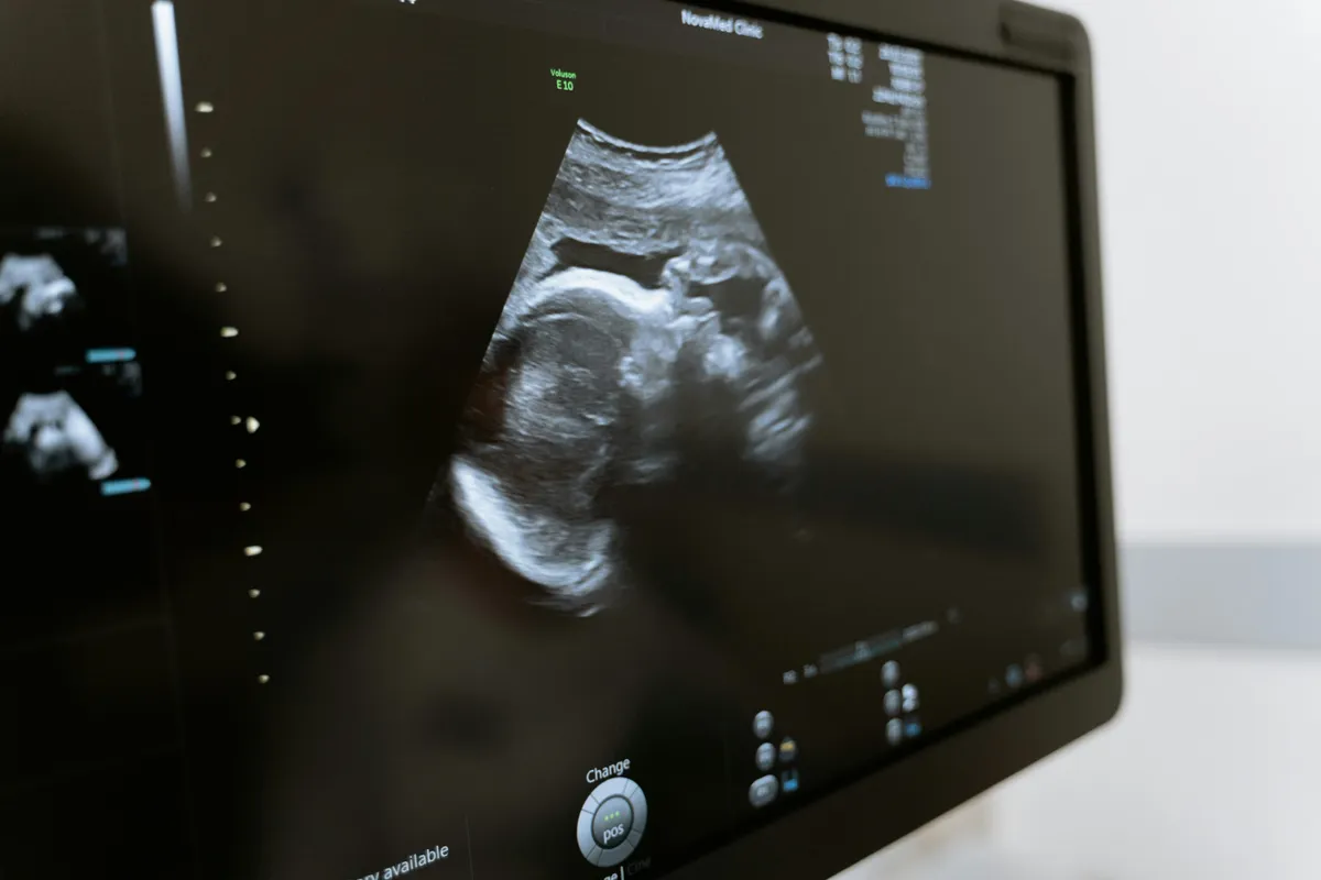 Mój mąż zostawił mnie z nowo narodzonymi trojaczkami – wiele lat później spotkałam go przypadkowo